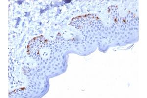 Immunohistochemistry (IHC) image for anti-Premelanosome Protein (PMEL) (AA 376-502) antibody (ABIN6940589)
