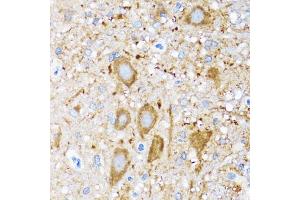Immunohistochemistry of paraffin-embedded mouse spinal cord using HSPH1 antibody.