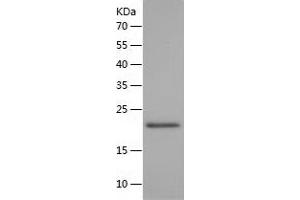 Western Blotting (WB) image for Desert Hedgehog (DHH) (AA 24-198) protein (His tag) (ABIN7122645) (desert Hedgehog Protein (AA 24-198) (His tag))