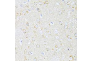 Immunohistochemistry of paraffin-embedded rat brain using MAP1LC3B antibody. (LC3B antibody)