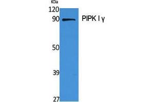 Western Blot (WB) analysis of specific cells using PIPK I gamma Polyclonal Antibody.