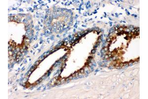 Immunohistochemistry (IHC) image for anti-Guanine Nucleotide Binding Protein (G Protein), Q Polypeptide (GNAQ) (AA 102-138), (N-Term) antibody (ABIN3043833)