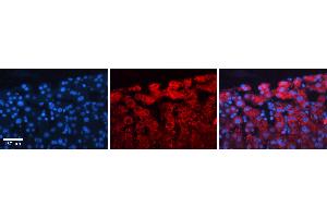 Rabbit Anti-ACLY Antibody   Formalin Fixed Paraffin Embedded Tissue: Human Liver Tissue Observed Staining: Cytoplasm in hepatocytes Primary Antibody Concentration: 1:100 Other Working Concentrations: N/A Secondary Antibody: Donkey anti-Rabbit-Cy3 Secondary Antibody Concentration: 1:200 Magnification: 20X Exposure Time: 0. (ACLY antibody  (Middle Region))