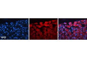 Rabbit Anti-ACLY Antibody   Formalin Fixed Paraffin Embedded Tissue: Human Liver Tissue Observed Staining: Cytoplasm in hepatocytes Primary Antibody Concentration: 1:100 Other Working Concentrations: N/A Secondary Antibody: Donkey anti-Rabbit-Cy3 Secondary Antibody Concentration: 1:200 Magnification: 20X Exposure Time: 0. (ACLY antibody  (Middle Region))