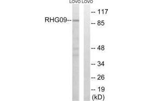 Western blot analysis of extracts from LOVO cells, using RHG9 antibody. (ARHGAP9 antibody)