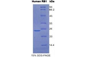 SDS-PAGE (SDS) image for Retinoblastoma 1 (RB1) (AA 753-928) protein (His tag) (ABIN1099431) (Retinoblastoma 1 Protein (RB1) (AA 753-928) (His tag))