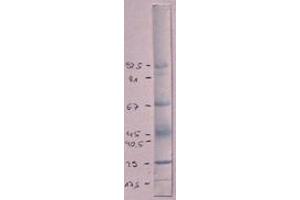 Immunoblot using anti-RSV-Hyperimmune Serum (Marker: Amidoblack) (Respiratory Syncytial Virus Long Strain (RSV Long) antibody)