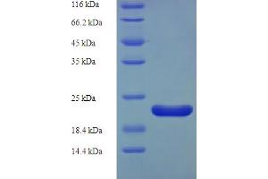 SDS-PAGE (SDS) image for Regenerating Islet-Derived 3 alpha (REG3A) (AA 26-174) protein (His tag) (ABIN5710237) (REG3A Protein (AA 26-174) (His tag))
