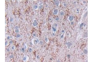 Detection of TDH in Human Cerebrum Tissue using Polyclonal Antibody to L-Threonine Dehydrogenase (TDH) (Tdh antibody  (AA 1-229))