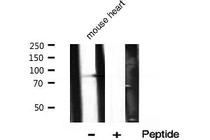 PIK3R1 antibody  (pTyr607)