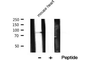 Western blot analysis of Phospho-PI3K p85 alpha (Tyr607) expression in Mouse heart tissue lysate