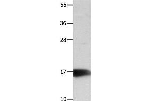 Western Blot analysis of Mouse kidney tissue using NME3 Polyclonal Antibody at dilution of 1:800 (NME3 antibody)