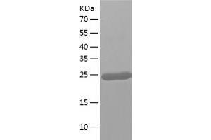 Western Blotting (WB) image for Glutathione S-Transferase, pi 2 (GSTP2) (AA 1-210) protein (His tag) (ABIN7286197) (GSTP2 Protein (AA 1-210) (His tag))