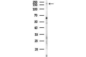 Western blot analysis of lysates from B16F10-LUC cells(heat-shock 45 min treatment), using Phospho-LRP6 (Ser1420) Antibody at 1/1000 dilution.