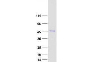 ENTPD5 Protein (Myc-DYKDDDDK Tag)