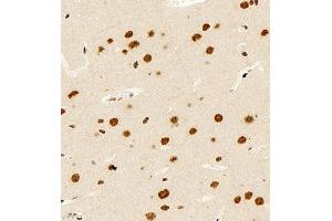Immunohistochemistry of paraffin embedded rat brain using smad62024 (ABIN7075629) at dilution of 1:1000 (400x lens) (SMAD6 antibody)
