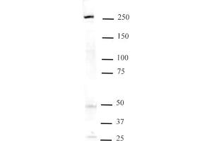 Mi-2 beta pAb tested by Western blot. (CHD4 antibody)