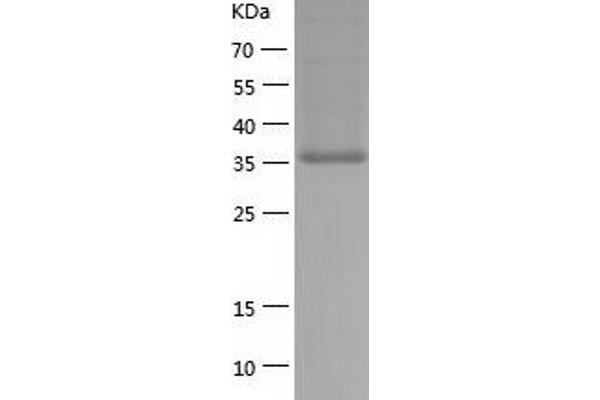 PDGFD Protein (AA 24-370) (His tag)