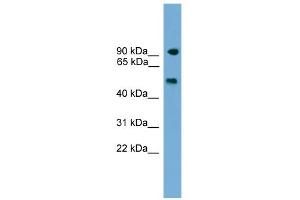 WB Suggested Anti-Parp8 Antibody Titration: 0. (PARP8 antibody  (C-Term))