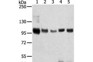 Western Blot analysis of Mouse brain and Human brain tissue, Human prostate tissue, Human fat and placenta tissue using SORT1 Polyclonal Antibody at dilution of 1:200 (Sortilin 1 antibody)