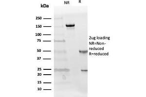 SDS-PAGE Analysis Purified Follistatin Mouse Monoclonal Antibody (FST/4281). (Follistatin antibody)