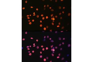 Immunofluorescence analysis of C6 cells using MonoMethyl-Histone H3-R17 Rabbit pAb (ABIN3017467, ABIN3017468, ABIN3017469 and ABIN6220100) at dilution of 100 (40x lens). (Histone 3 antibody  (H3R17me))