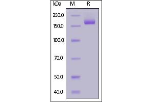 SARS-CoV-2 Spike Trimer, His Tag (B. (SARS-CoV-2 Spike Protein (B.1.1.529 - Omicron, Trimer) (His tag))