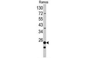 Western blot analysis of RPS9 antibody (C-term) in Ramos cell line lysates (35ug/lane). (RPS9 antibody  (C-Term))