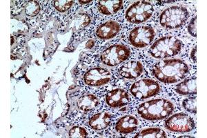 Immunohistochemistry (IHC) analysis of paraffin-embedded Human Colon, antibody was diluted at 1:100. (IL1R2 antibody  (Internal Region))