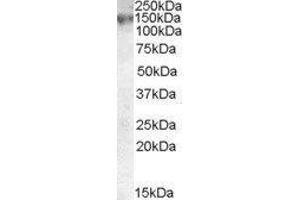 Western Blotting (WB) image for ATP-Binding Cassette, Sub-Family C (CFTR/MRP), Member 1 (ABCC1) peptide (ABIN369197) (ATP-Binding Cassette, Sub-Family C (CFTR/MRP), Member 1 (ABCC1) Peptide)