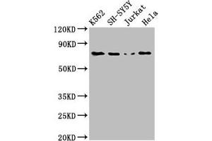 Western Blot Positive WB detected in: K562 whole cell lysate, SH-SY5Y whole cell lysate, Jurkat whole cell lysate, Hela whole cell lysate All lanes: PRKCB antibody at 3 μg/mL Secondary Goat polyclonal to rabbit IgG at 1/50000 dilution Predicted band size: 77, 78 kDa Observed band size: 77 kDa (PKC beta antibody  (AA 517-643))