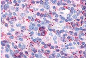 Anti-P2RY6 / P2Y6 antibody  ABIN1049220 IHC staining of human spleen, red pulp.