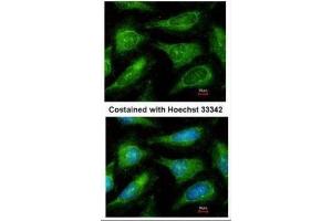 ICC/IF Image Immunofluorescence analysis of methanol-fixed HeLa, using c-Yes, antibody at 1:200 dilution. (YES1 antibody  (Center))