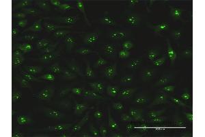 Immunofluorescence (IF) image for anti-S100 Calcium Binding Protein A7 (S100A7) (AA 1-101) antibody (ABIN519957)