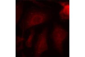 Immunofluorescence staining of methanol-fixed HeLa cells using Phospho-MAPT-S404 antibody (ABIN2987503).