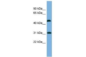 WB Suggested Anti-CTDSP2 Antibody Titration: 0.