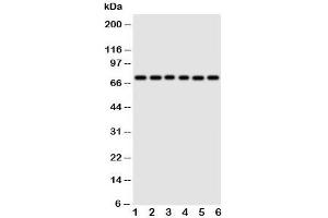 Western blot testing of Splicing factor 1 antibody and Lane 1:  rat spleen;  2: rat liver;  3: PANC;  4: COLO320;  5: SW620;  6: SKOV cell lysate