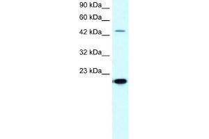 MMP19 antibody used at 5-10 ug/ml to detect target protein.
