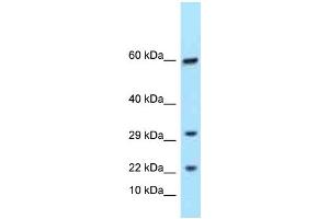Western Blotting (WB) image for anti-T Cell Receptor gamma Variable 9 (TRGV9) (C-Term) antibody (ABIN2788572) (TRGC1 antibody  (C-Term))