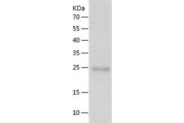 RHOD Protein (AA 1-210) (His tag)