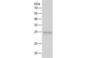 Western Blotting (WB) image for Ras Homolog Family Member D (RHOD) (AA 1-210) protein (His tag) (ABIN7124781) (RHOD Protein (AA 1-210) (His tag))