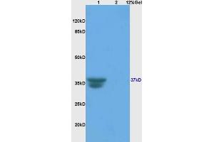 L1 rat liver, L2 rat brain lysates probed (ABIN687532) at 1:200 in 4 °C.