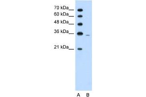 WB Suggested Anti-PRPS2 Antibody Titration:  1.