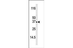 Image no. 1 for anti-BCL2-Interacting Killer (Apoptosis-Inducing) (BIK) (pThr33) antibody (ABIN358090)