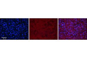Rabbit Anti-MASP2 Antibody      Formalin Fixed Paraffin Embedded Tissue: Human Adult Liver   Observed Staining: Cytoplasm in hepatocytes, weak signal, wide tissue distribution   Primary Antibody Concentration: 1:100  Secondary Antibody: Donkey anti-Rabbit-Cy3  Secondary Antibody Concentration: 1:200  Magnification: 20X  Exposure Time: 0. (MASP2 antibody  (N-Term))