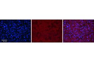 Rabbit Anti-MASP2 Antibody      Formalin Fixed Paraffin Embedded Tissue: Human Adult Liver   Observed Staining: Cytoplasm in hepatocytes, weak signal, wide tissue distribution   Primary Antibody Concentration: 1:100  Secondary Antibody: Donkey anti-Rabbit-Cy3  Secondary Antibody Concentration: 1:200  Magnification: 20X  Exposure Time: 0. (MASP2 antibody  (N-Term))
