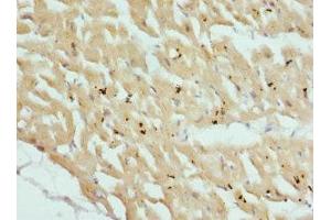 Immunohistochemistry of paraffin-embedded human heart tissue using ABIN7149013 at dilution of 1:100 (CSRP3 antibody  (AA 1-194))