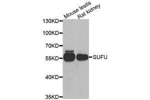 Western blot analysis of extracts of various cell lines, using SUFU antibody. (SUFUH antibody  (AA 325-484))