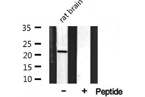 Western blot analysis on rat brain lysate using Musculin Antibody (Musculin antibody  (Internal Region))