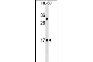 CALCA/CT Antibody ABIN1536608 western blot analysis in HL-60 cell line lysates (35 μg/lane). (Calcitonin antibody  (AA 104-132))